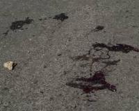 Девочка-инвалид из детдома в Приморье разбилась насмерть, выпав из окна